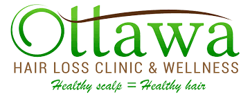 Ottawa Hair Loss & Wellness